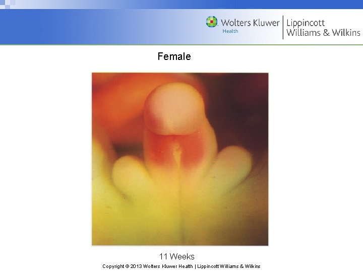 Female 11 Weeks Copyright © 2013 Wolters Kluwer Health | Lippincott Williams & Wilkins