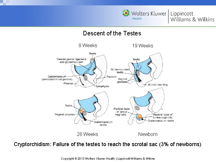 Descent of the Testes 8 Weeks 28 Weeks 19 Weeks Newborn Cryptorchidism: Failure of
