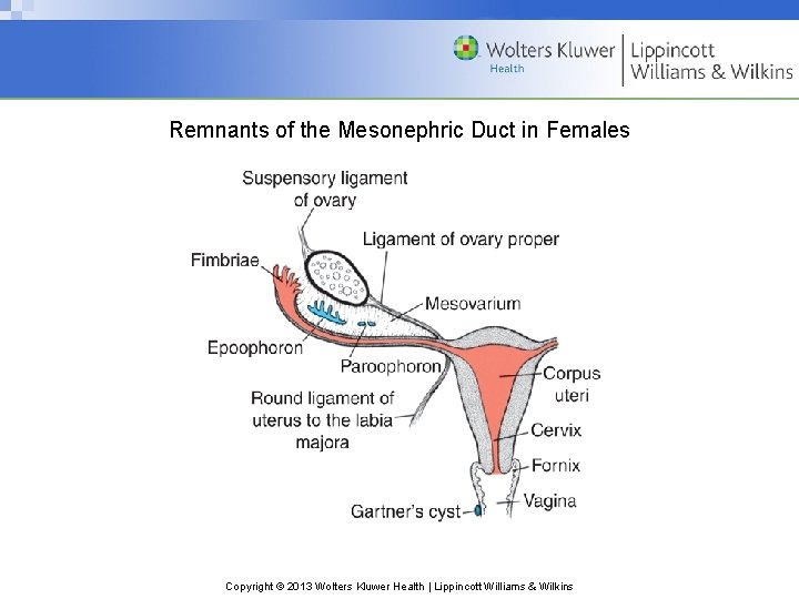 Remnants of the Mesonephric Duct in Females Copyright © 2013 Wolters Kluwer Health |