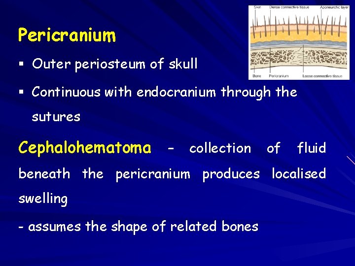 Pericranium § Outer periosteum of skull § Continuous with endocranium through the sutures Cephalohematoma