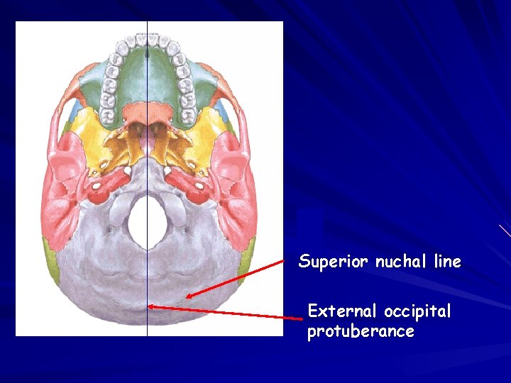 Superior nuchal line External occipital protuberance 