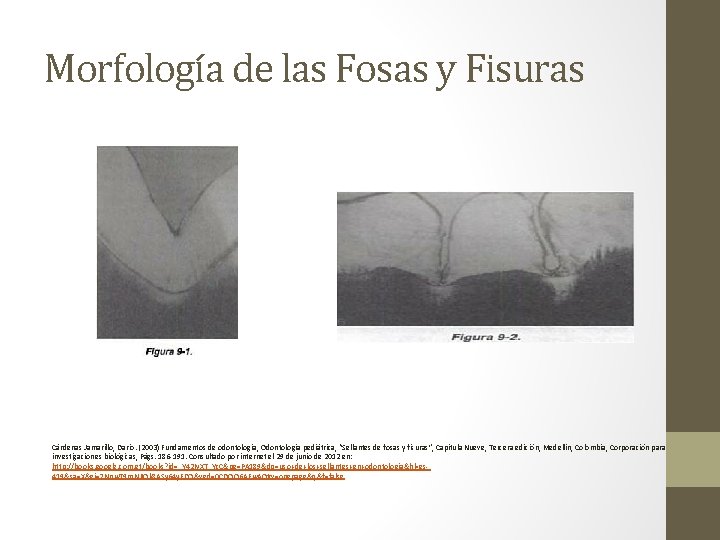 Morfología de las Fosas y Fisuras Cárdenas Jamarillo, Darío. (2003) Fundamentos de odontología, Odontología
