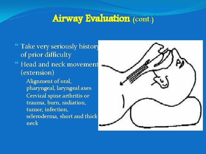 Airway Evaluation (cont. ) Take very seriously history of prior difficulty Head and neck
