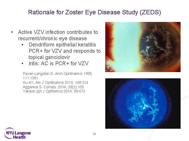 Rationale for Zoster Eye Disease Study (ZEDS) • Active VZV infection contributes to recurrent/chronic