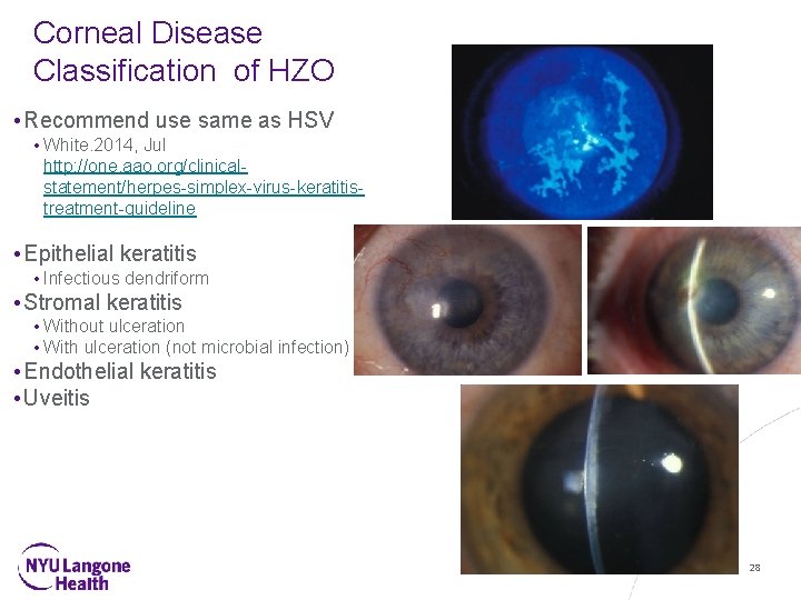 Corneal Disease Classification of HZO • Recommend use same as HSV • White. 2014,