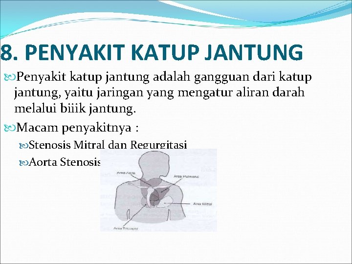 8. PENYAKIT KATUP JANTUNG Penyakit katup jantung adalah gangguan dari katup jantung, yaitu jaringan