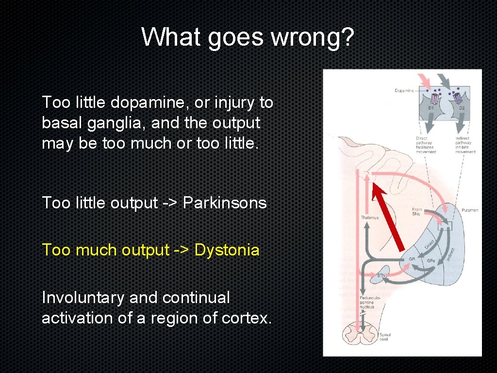 What goes wrong? Too little dopamine, or injury to basal ganglia, and the output