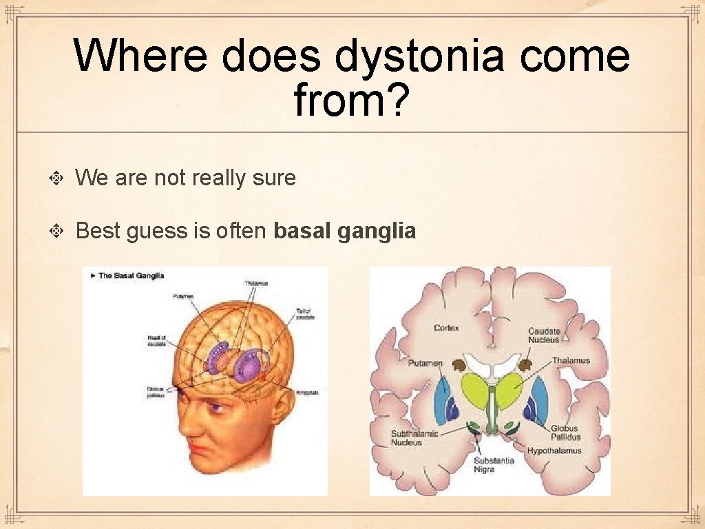 Where does dystonia come from? We are not really sure Best guess is often