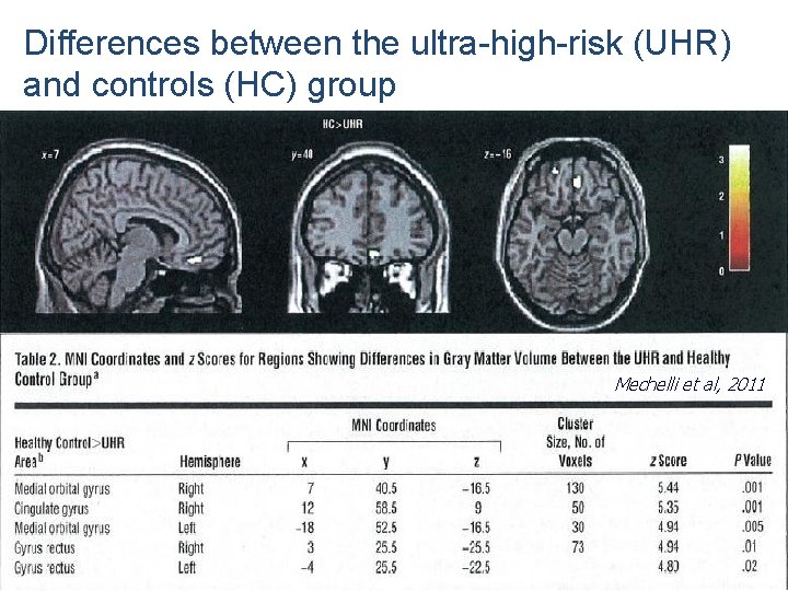 Differences between the ultra-high-risk (UHR) and controls (HC) group Mechelli et al, 2011 