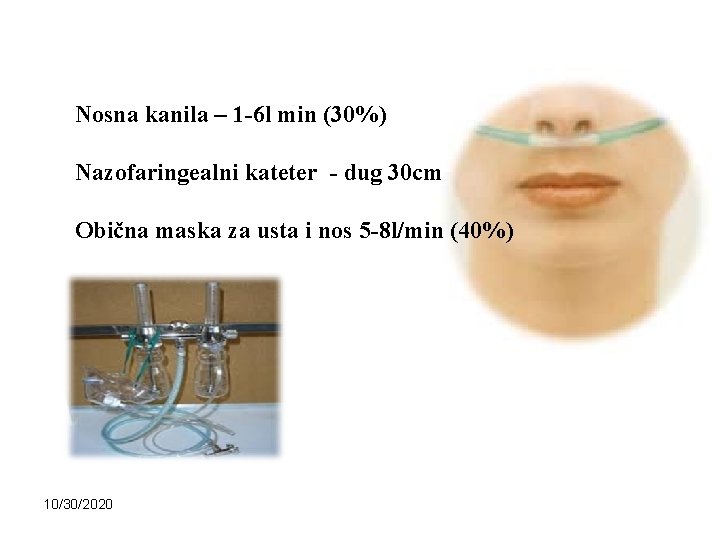 Nosna kanila – 1 -6 l min (30%) Nazofaringealni kateter - dug 30 cm