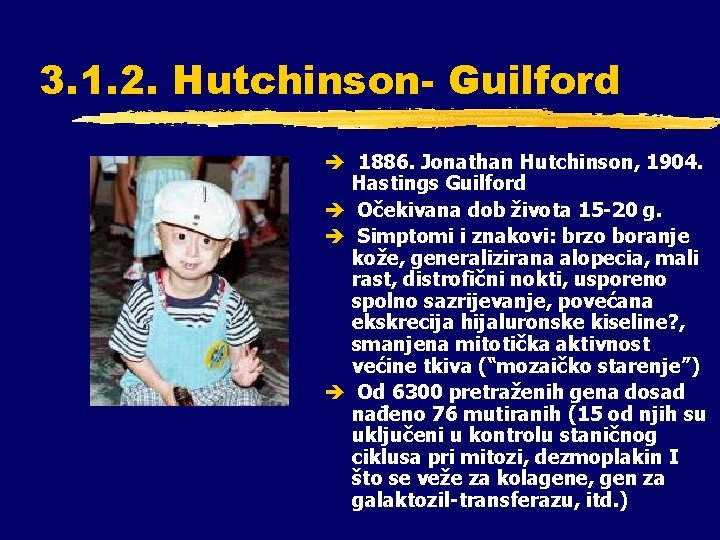 3. 1. 2. Hutchinson- Guilford è 1886. Jonathan Hutchinson, 1904. Hastings Guilford è Očekivana