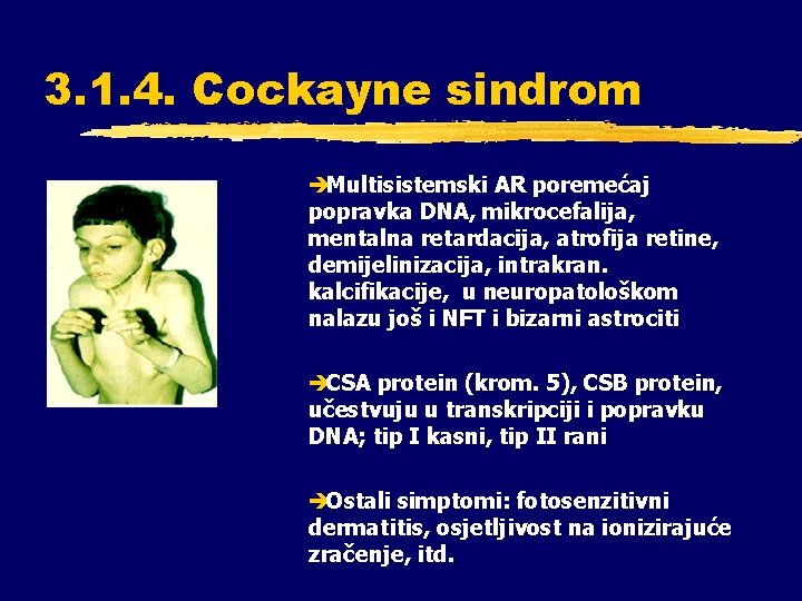 3. 1. 4. Cockayne sindrom èMultisistemski AR poremećaj popravka DNA, mikrocefalija, mentalna retardacija, atrofija