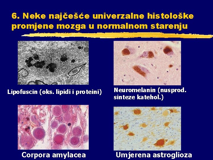 6. Neke najčešće univerzalne histološke promjene mozga u normalnom starenju Lipofuscin (oks. lipidi i