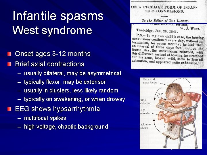 Infantile spasms West syndrome Onset ages 3 -12 months Brief axial contractions – –