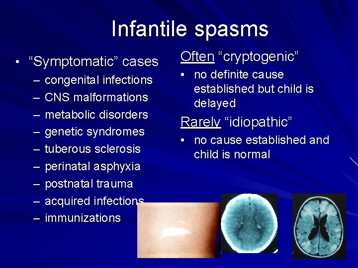 Infantile spasms • “Symptomatic” cases – congenital infections – CNS malformations – metabolic disorders