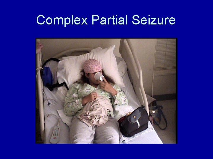 Complex Partial Seizure 