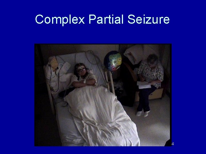 Complex Partial Seizure 34 Complex Partial Seizure 34