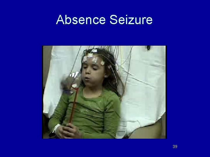 Absence Seizure 39 