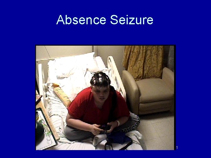 Absence Seizure 41 