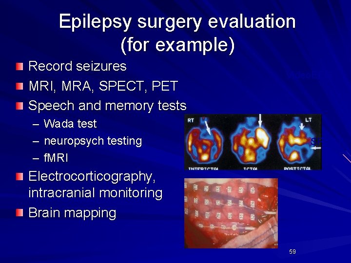 Epilepsy surgery evaluation (for example) Record seizures MRI, MRA, SPECT, PET Speech and memory