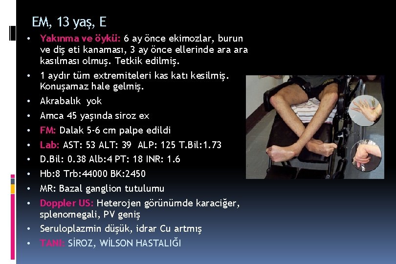 EM, 13 yaş, E • • • Yakınma ve öykü: 6 ay önce ekimozlar, EM, 13 yaş, E • • • Yakınma ve öykü: 6 ay önce ekimozlar,
