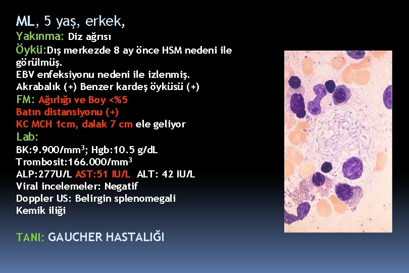 ML, 5 yaş, erkek, Yakınma: Diz ağrısı Öykü: Dış merkezde 8 ay önce HSM ML, 5 yaş, erkek, Yakınma: Diz ağrısı Öykü: Dış merkezde 8 ay önce HSM