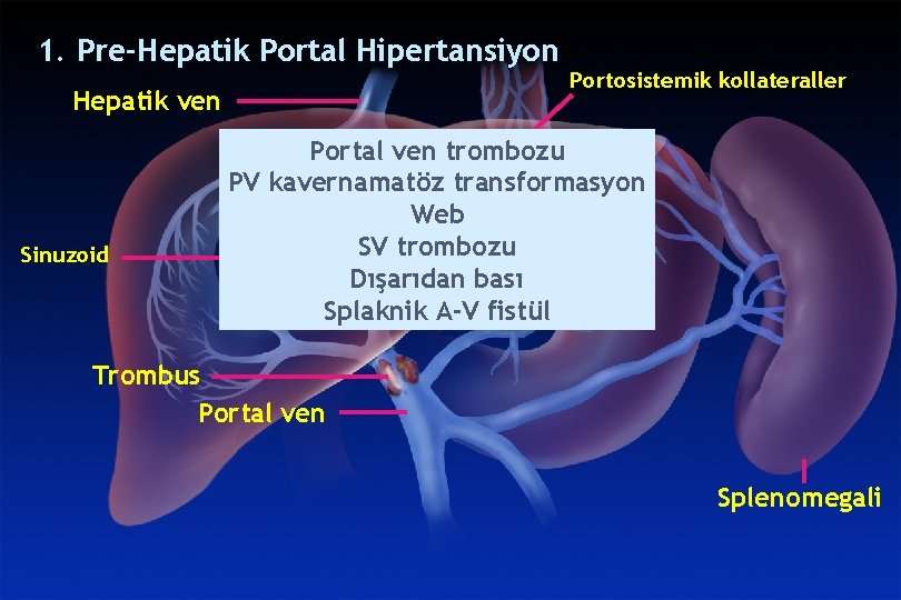 Portal ven - Vikipedi