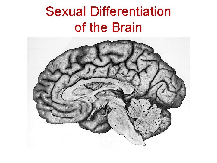 Sexual Differentiation of the Brain 