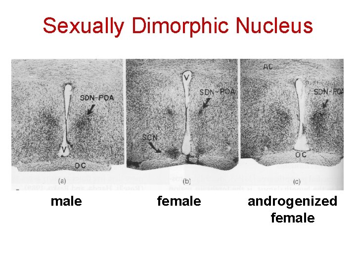 Sexually Dimorphic Nucleus male female androgenized female 