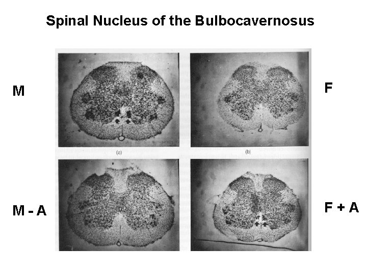 Spinal Nucleus of the Bulbocavernosus M F M-A F+A 