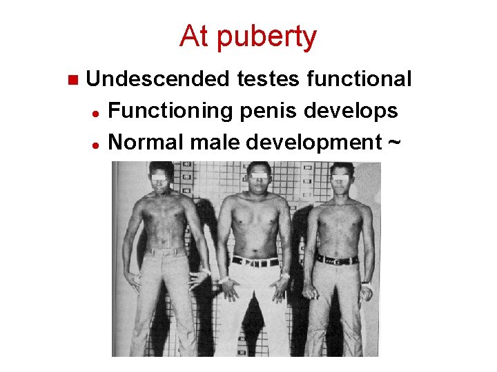 At puberty n Undescended testes functional l Functioning penis develops l Normal male development