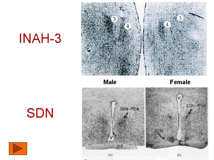 INAH-3 Male SDN Female 