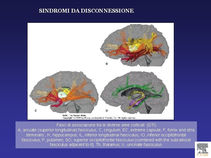 SINDROMI DA DISCONNESSIONE Fasci di associazione tra le diverse aree corticali (DTI) A, arcuate