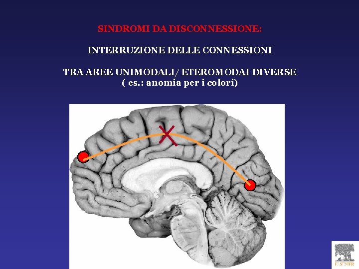 SINDROMI DA DISCONNESSIONE: INTERRUZIONE DELLE CONNESSIONI TRA AREE UNIMODALI/ ETEROMODAI DIVERSE ( es. :
