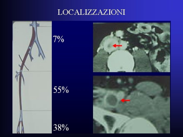 LOCALIZZAZIONI LOCALIZZAZIONI