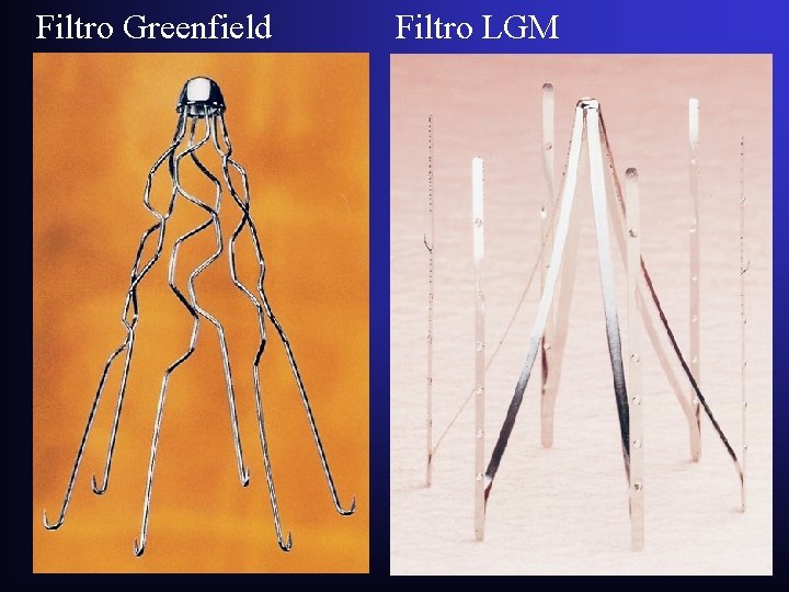 Filtro Greenfield Filtro LGM Filtro Greenfield Filtro LGM