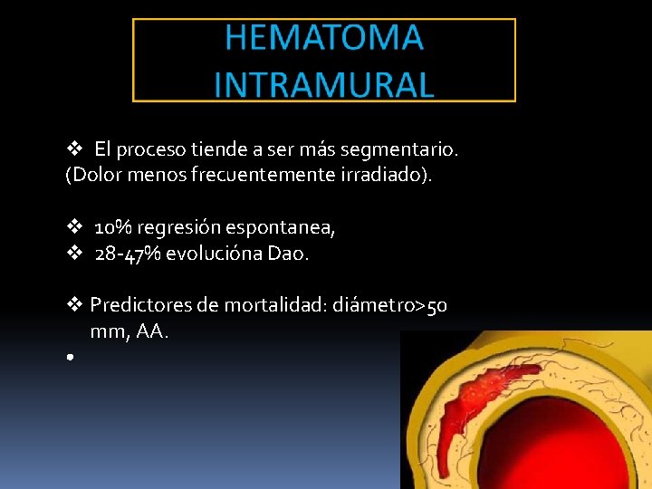 v El proceso tiende a ser más segmentario. (Dolor menos frecuentemente irradiado). v 10% v El proceso tiende a ser más segmentario. (Dolor menos frecuentemente irradiado). v 10%