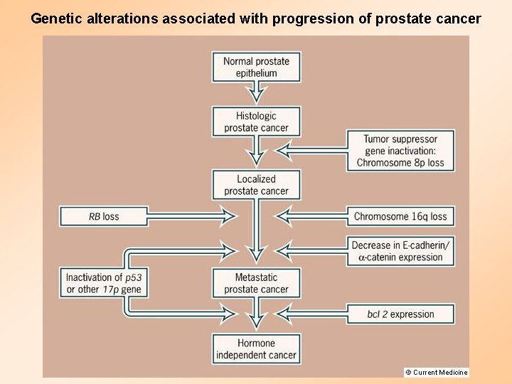 Genetic alterations associated with progression of prostate cancer 