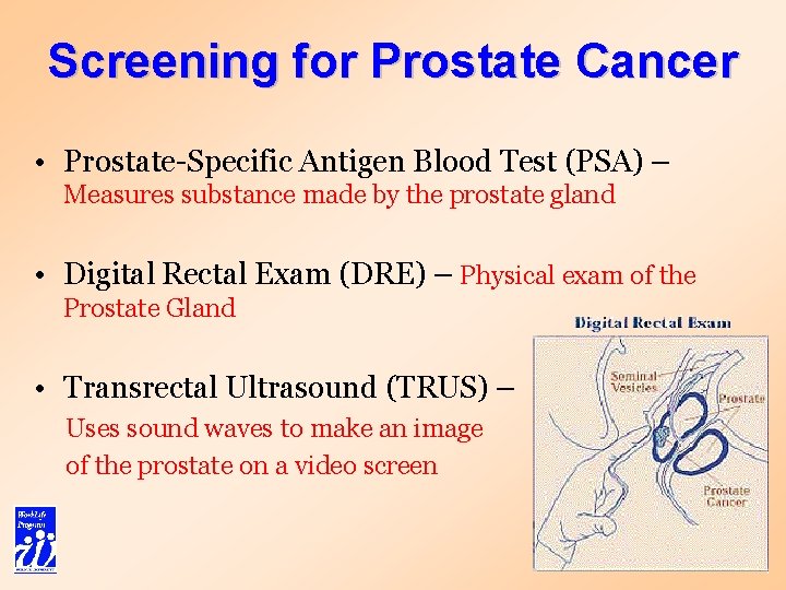Screening for Prostate Cancer • Prostate-Specific Antigen Blood Test (PSA) – Measures substance made