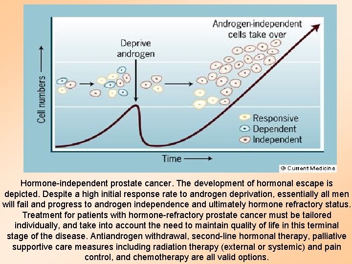 Hormone-independent prostate cancer. The development of hormonal escape is depicted. Despite a high initial