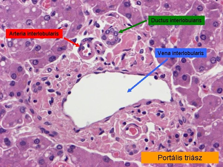 Ductus interlobularis Arteria interlobularis Vena interlobularis Portális triász 