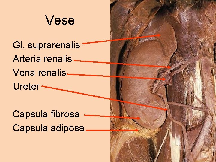 Vese Gl. suprarenalis Arteria renalis Vena renalis Ureter Capsula fibrosa Capsula adiposa 