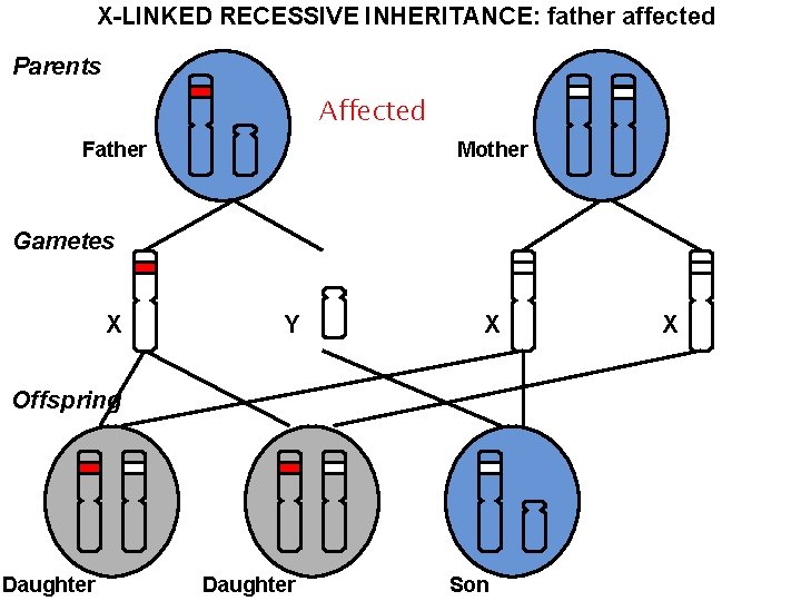 X-LINKED RECESSIVE INHERITANCE: father affected Parents Affected Father Mother Gametes X Y X Offspring