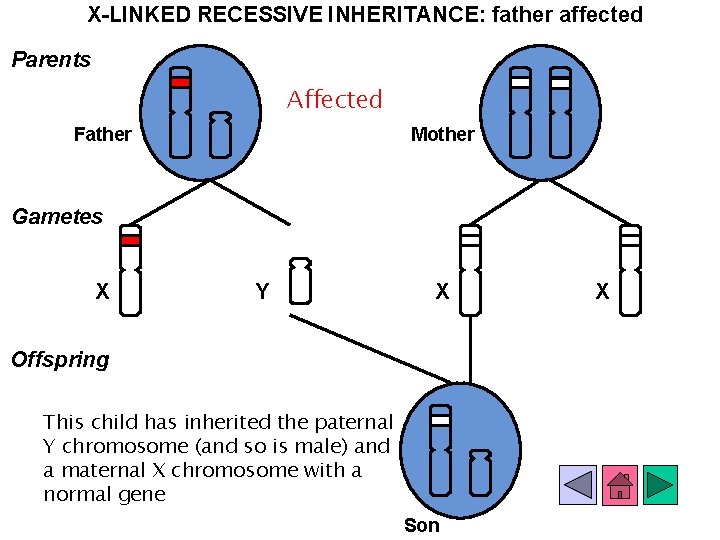 X-LINKED RECESSIVE INHERITANCE: father affected Parents Affected Father Mother Gametes X Y X Offspring