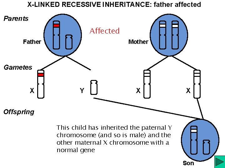X-LINKED RECESSIVE INHERITANCE: father affected Parents Affected Father Mother Gametes X Y X X