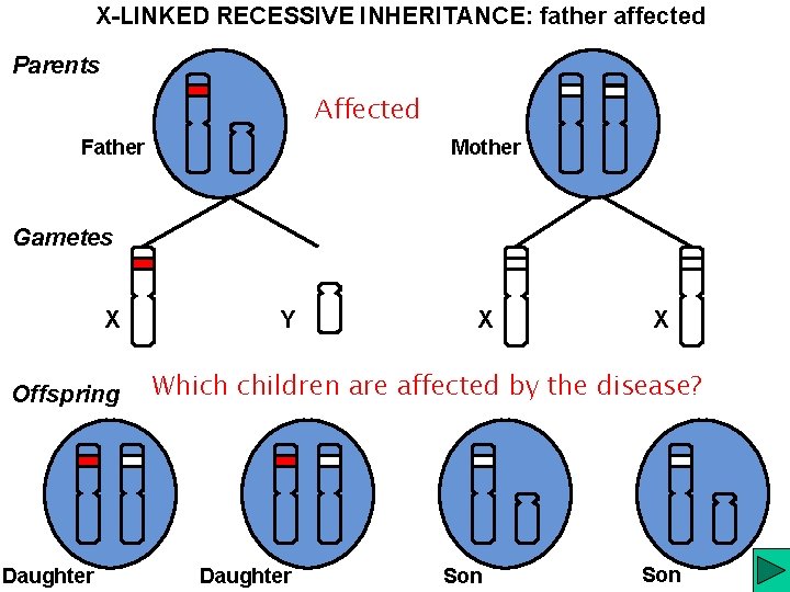 X-LINKED RECESSIVE INHERITANCE: father affected Parents Affected Father Mother Gametes X Offspring Daughter Y