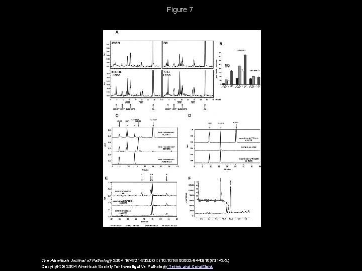 Figure 7 The American Journal of Pathology 2004 164521 -532 DOI: (10. 1016/S 0002