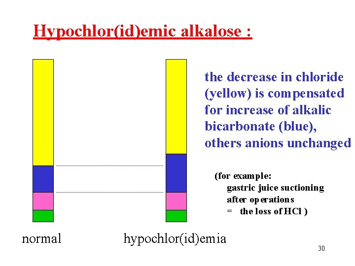 Hypochlor(id)emic alkalose : the decrease in chloride (yellow) is compensated for increase of alkalic