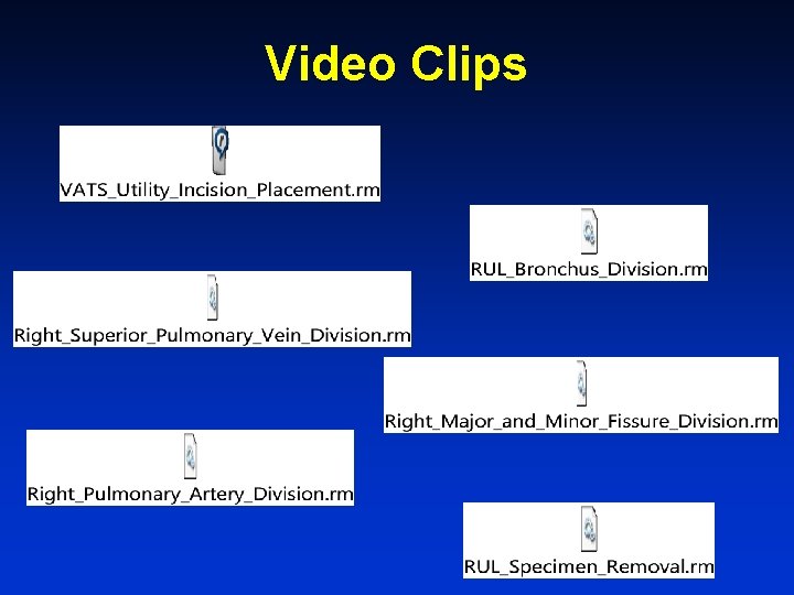 Video Clips 