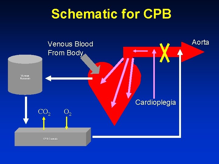 Schematic for CPB Aorta Venous Blood From Body Venous Reservoir Cardioplegia CO 2 CPB